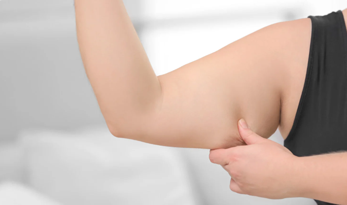 Image Arm Fat