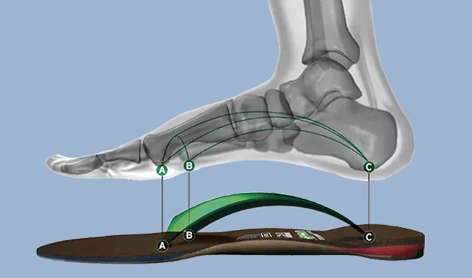 Image Why Choose Custom Orthotics