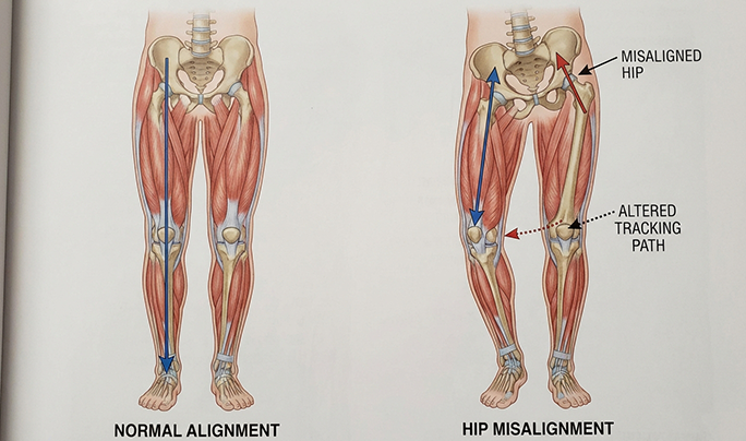 Image Why Foot and Knee Pain Commonly Overlap